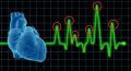860-header-opto-hearts-iStock_000003733724_Large.jpg
