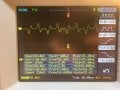 B counter, Yn voltages.JPG
