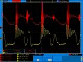 rgate1_yout_Is035A_Vs105V.jpg