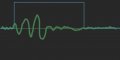 pulse.jpg
