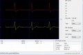 heartbeat.jpg