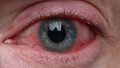 medium-1627902990-how-long-could-you-last-without-sleep.jpg