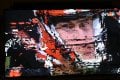 NBC 5 Pixelated.JPG