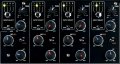 Allen&Heath XONE DB4 INPUT SELECT.jpg