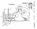 US4320756-drawings-page-2.jpg US4320756-drawings-page-2.jpg