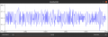 ecg_1.png