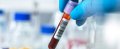 blood_tube_AD-600x243.jpg