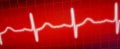 HeartbeatDiagramInRed-600x243.jpg