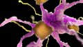 Brain-plaque-600x338.jpg