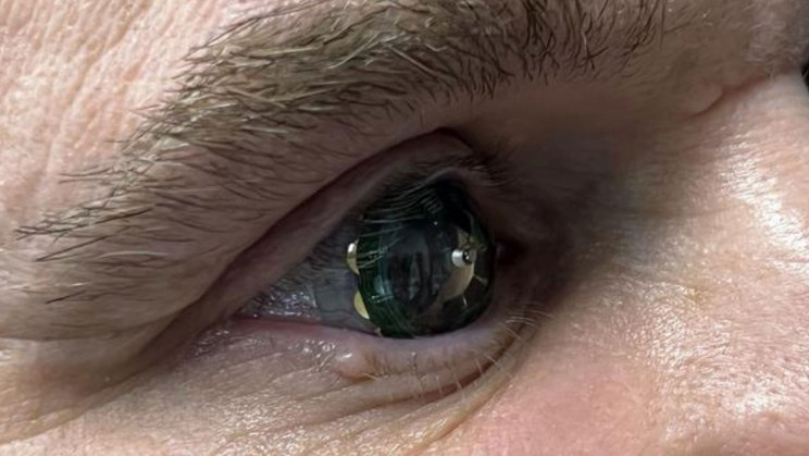 Smart contact lenses with AR display trialed for the first time Smart contact lenses with AR display trialed for the first time